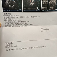 36 2的彩超，宝妈帮忙看看男宝女宝，快生了比较好奇，谢谢😃😃