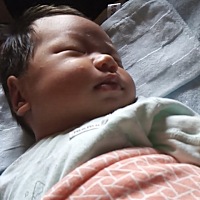 谁知道这是湿疹吗