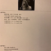 去了医院做个超就被碾回来了，不是应该再验一下孕酮什么的吗，求解