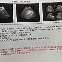 亲们，帮我看看，是男宝还是女宝。