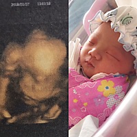 大家帮我看看我家宝宝出生和四维像吗。