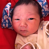 宝宝身上脸上起红色的这东西是太热了吗？