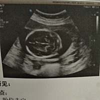 女儿呀女儿，你也太调皮了吧！平时拳打脚踢也就算了，可不能这么玩，快点转过来吧！😓😓😓