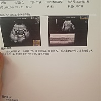 怀孕快五个月了，猜猜男女