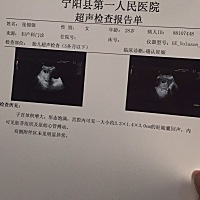 bc单子妊娠囊大小看男孩女孩