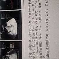 谁看得懂这个单子上用黑笔写是什么意思？