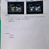 老公弱精症，我带环怀孕，检查发现环可能已经掉了，现在已经7周了，老公坚信这个孩子不健康，极力劝阻我...
