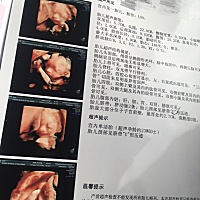 四维照帮忙看看是男宝还是女宝，去医院检查两次都看不出来，宝宝太调皮，一直双腿夹紧在睡觉。。