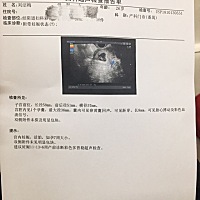 终于安心了！各宝妈初孕应该要注意点什么！需要补充点什么？