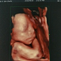 四维回来，宝宝一切安好，亲戚朋友看了都说是男孩子，我和老公男女都喜欢，都是自己的宝贝，以后健健康...