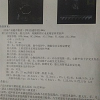 你们四维彩超是这样的吗，为什么我跟别人做的不一样，别人都是很清晰的看到肚子的宝宝，我的却是乌漆嘛...