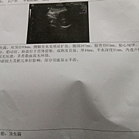 帮忙看一下，我是二胎，能不能顺产！做了检查我看不懂😞