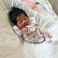 准妈妈你们都问孕期吃了什么？大部分原因跟遗传有关吧！小孩爸爸满身都是毛头发也很茂盛。跟饮食没有多...