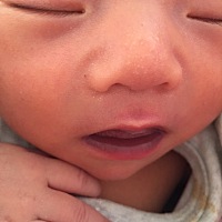 宝宝10.3.出生，10.9出医院测出黄疸，回家吃茵之黄这个药过了2.3天，发觉宝宝嘴唇发紫，去医院新生儿科...