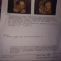 各位大神帮我看下男孩女孩，谢谢了。