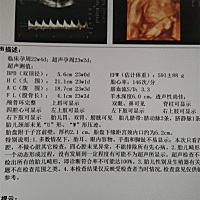 四维顺利通过，就是不知道是男宝还是女宝，有会看的吗😊？