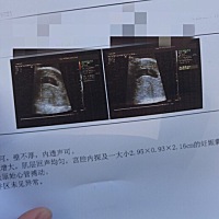 胎心已有，心情瞬间好多了，帮忙看看男女🙏🏻🙏🏻