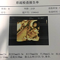 二宝感觉不像爸爸，鼻子像我哈哈有宝妈知道男宝女宝吗。