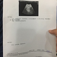 我这个检查结果正常吗