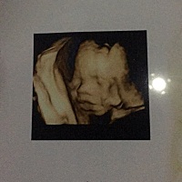 四维图片看来很像男宝，生下来会是男宝吗？各位宝妈有没经验，欢迎留言