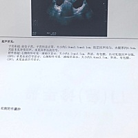 这个情况可以怀孕吗