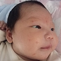 有谁知道宝宝脸上长什么了吗，