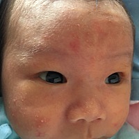 想问一下宝妈们宝宝脸上的是什么