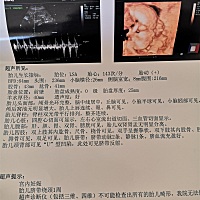 大家能帮看看是男孩女孩吗？特别好奇，我家大宝天天问我是男孩女孩