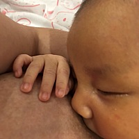 宝宝脸上有湿疹和脂肪粒怎么办啊 大家怎么治疗的呀