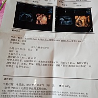 亲们，帮忙看看男女