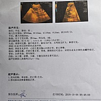 四维通过，看看是男宝还是女宝，纯属好奇