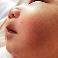 就这样的小红点怎么回事啊？