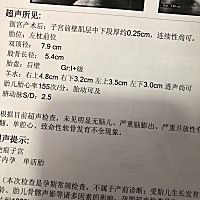 产检一次要半条命，能看得出男宝女宝吗？
