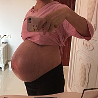 来报喜了😁侧切喜获6.2斤小公子一枚。22号中午办住院检查宫口已经开两指，打催产当天下午五六点开...