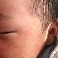 有人知道宝宝脸上起的这是什么吗？是不是我吃的咸还是什么原因 摸着很粗糙