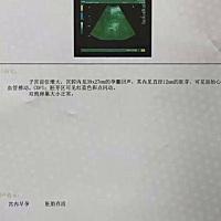 各位大神，帮忙看看男女^_^
