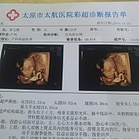 能看出来长得像谁 吗   爸爸说小孩在抠鼻屎😂