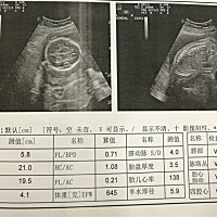 32 4，大排畸顺利通过，医生说女孩儿的可能性很大。。。
