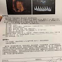 二胎帮忙看看是男孩还是女孩 谢谢