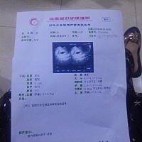 各位宝妈们，有没有会看男女的，其实男女对我而言都一样，就是有些好奇，毕竟是第一胎！！😁😁😁