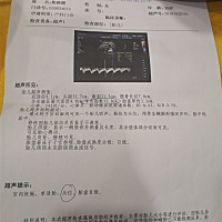 36 6 现在检查一切正常是不是代表可以顺产呢？