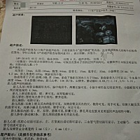 这是今天去照的四维，为什么我的没有那种可以看到宝宝脸的照片呢？