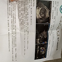 为什么检查的时候，照B超的人说我羊水有点偏少，然后拿单子问医生，医生又没说羊水偏少，搞不懂