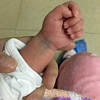 今天是宝宝是宝宝照蓝光的第二天了，一天有一个小时给孩子喂奶时间，昨天不敢去，我怕忍不住哭，怕别人...