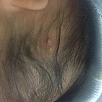 怎么办 身上和头上长了好多种痘痘。