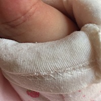 各位宝妈，请问有谁知道这是怎么回事尼，宝宝才3个多月