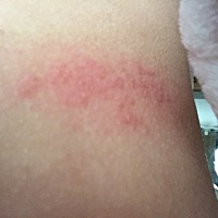 这长的什么，有点疼？