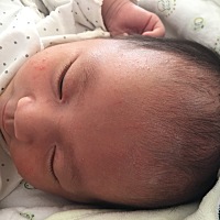 24天宝宝头上脸上出红点，像痱子似的但是有白尖。请问用什么药抹一下。