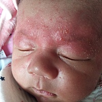 那个宝妈知道我家宝宝脸上的是什么？