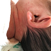 请问有谁知道宝宝身上长的这些痘痘是什么，怎样缓解吗？